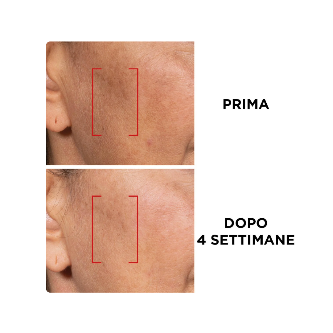 L'Oréal Paris Revitalift Laser X3 Crema Giorno SPF 25