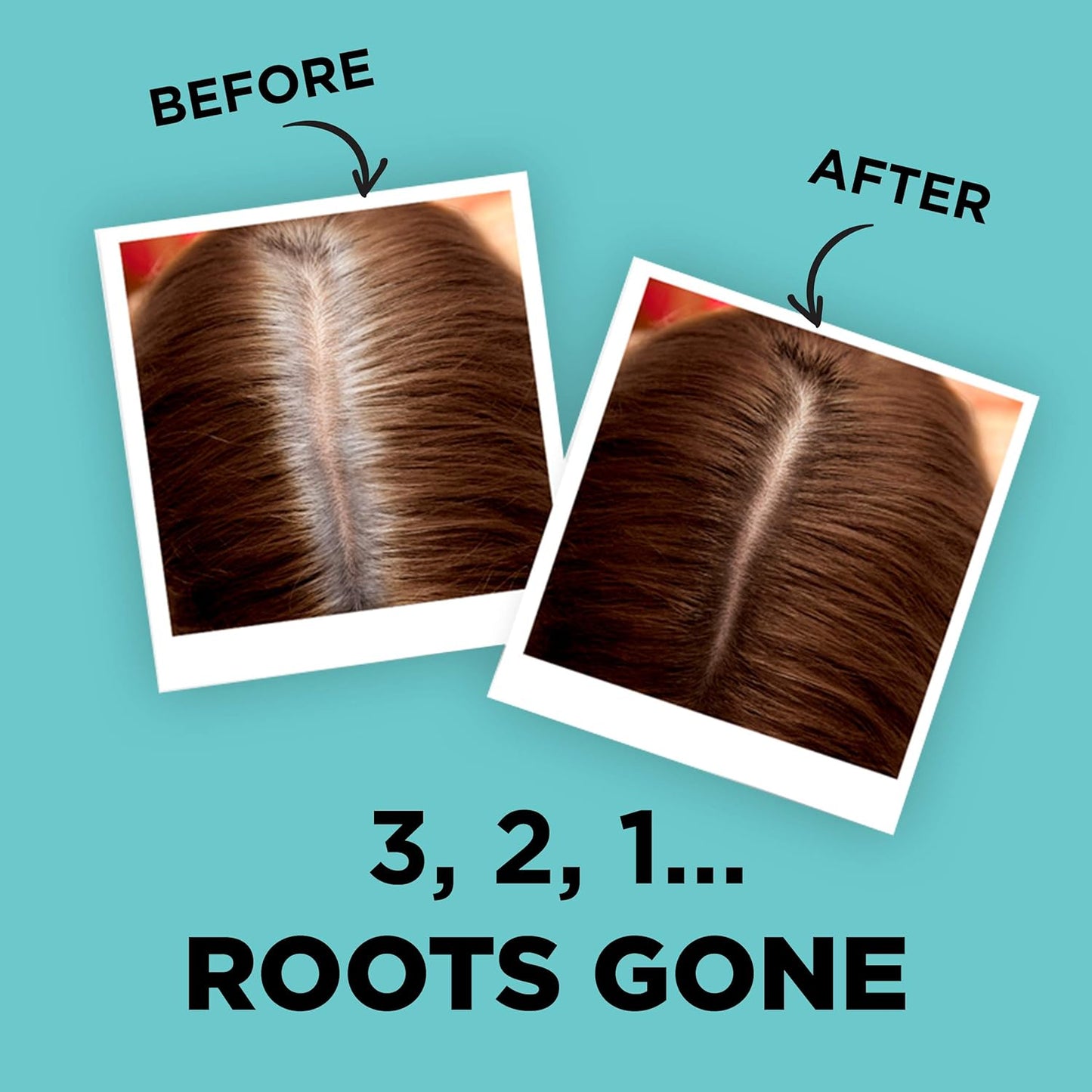 🤎 L’Oréal Paris Magic Retouch – Spray Ritocco Ricrescita Castano (75ml)
