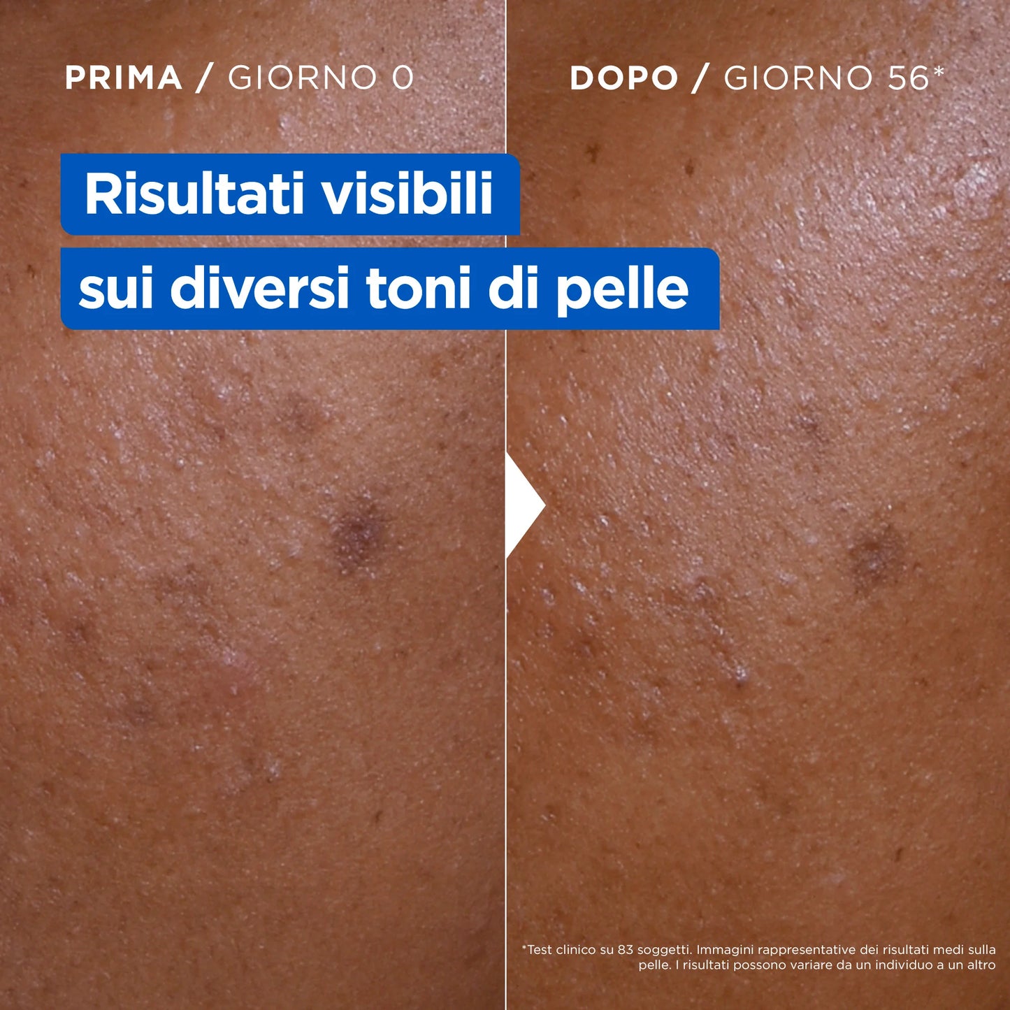 🌞 Mixa Niacinamide Bright – Crema Idratante Anti-Macchie – 400 ml